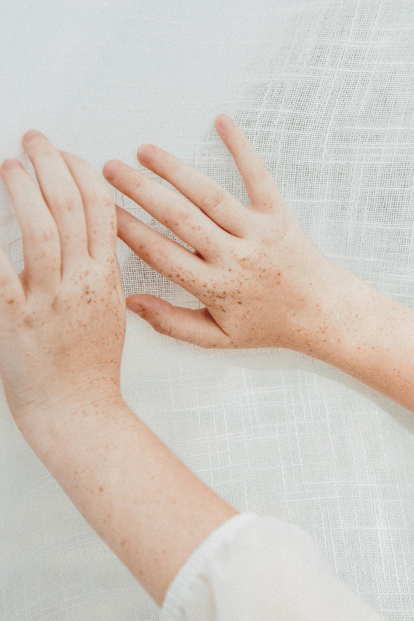 Beef Tallow for Eczema: Does It Really Work? Evidence Reviewed